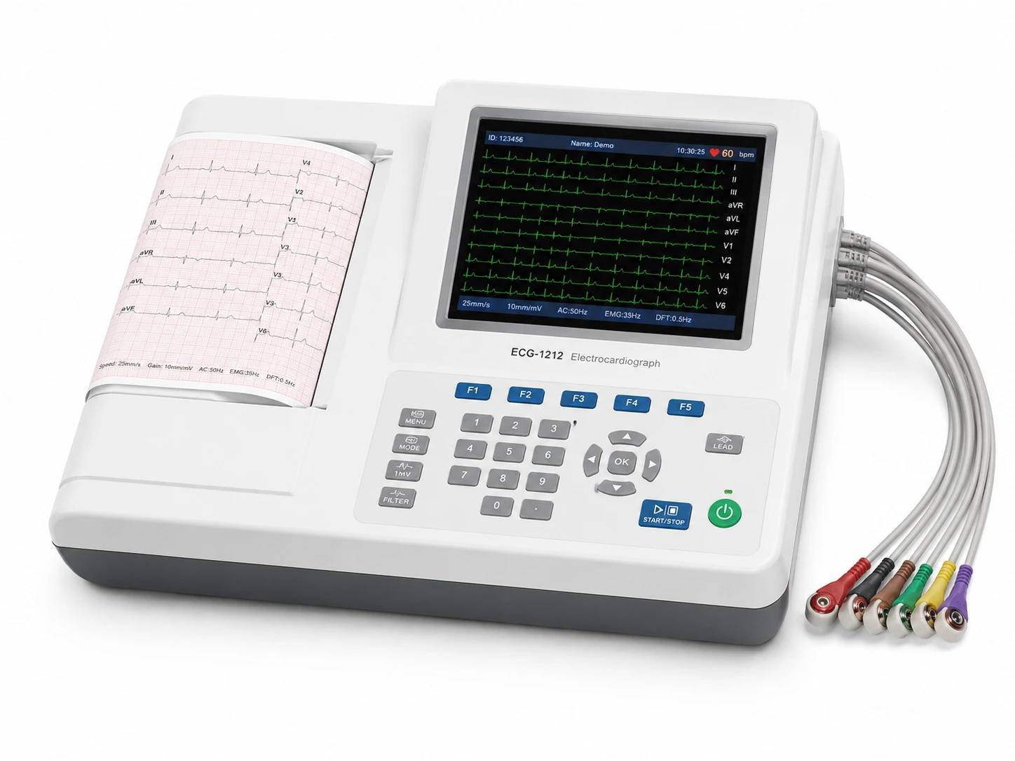 A 12-lead ECG machine (electrocardiograph) in a Singapore clinic, printing a heart rhythm trace onto graph paper